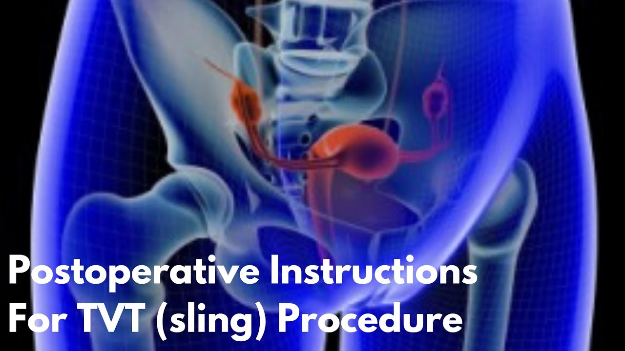 postoperative instructions tvt thumbnail